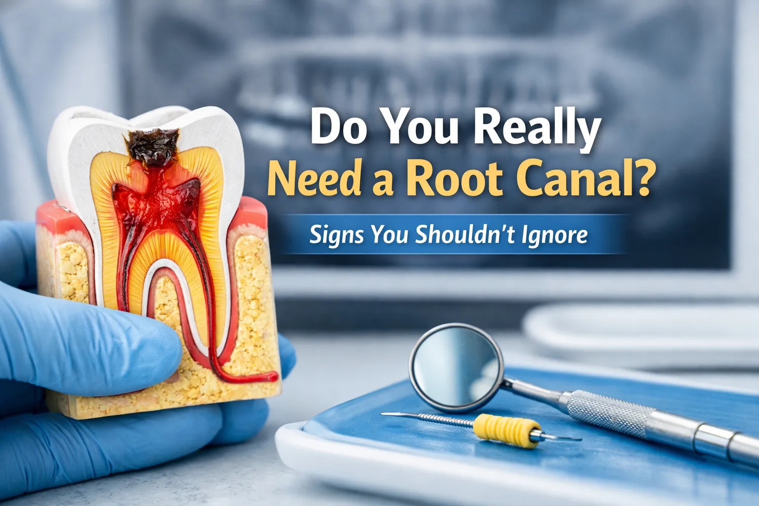 Do You Really Need a Root Canal? Signs You Shouldn’t Ignore