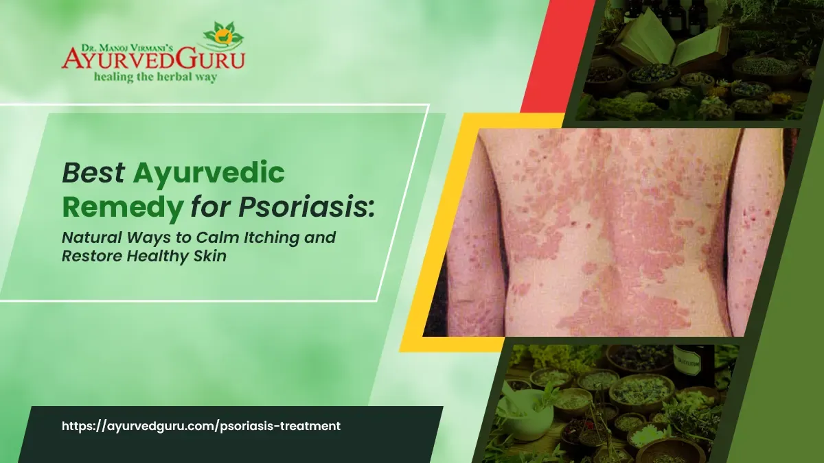 Best Ayurvedic Remedy for Psoriasis: Natural Ways to Calm Itching and Restore Healthy Skin