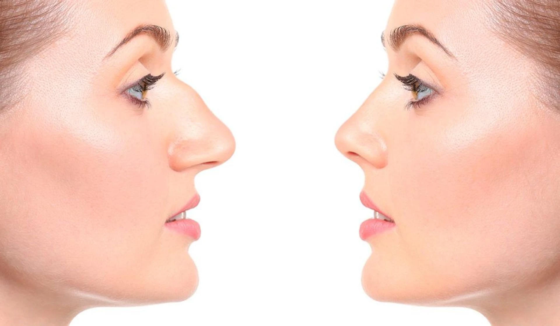 The Latest Trends in Nose Reshaping London: What’s New in Aesthetic Procedures