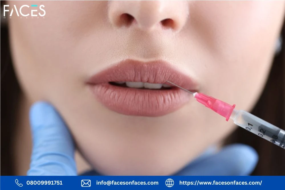 Lip Filler Course London: Your Path to Mastering Lip Augmentation Techniques