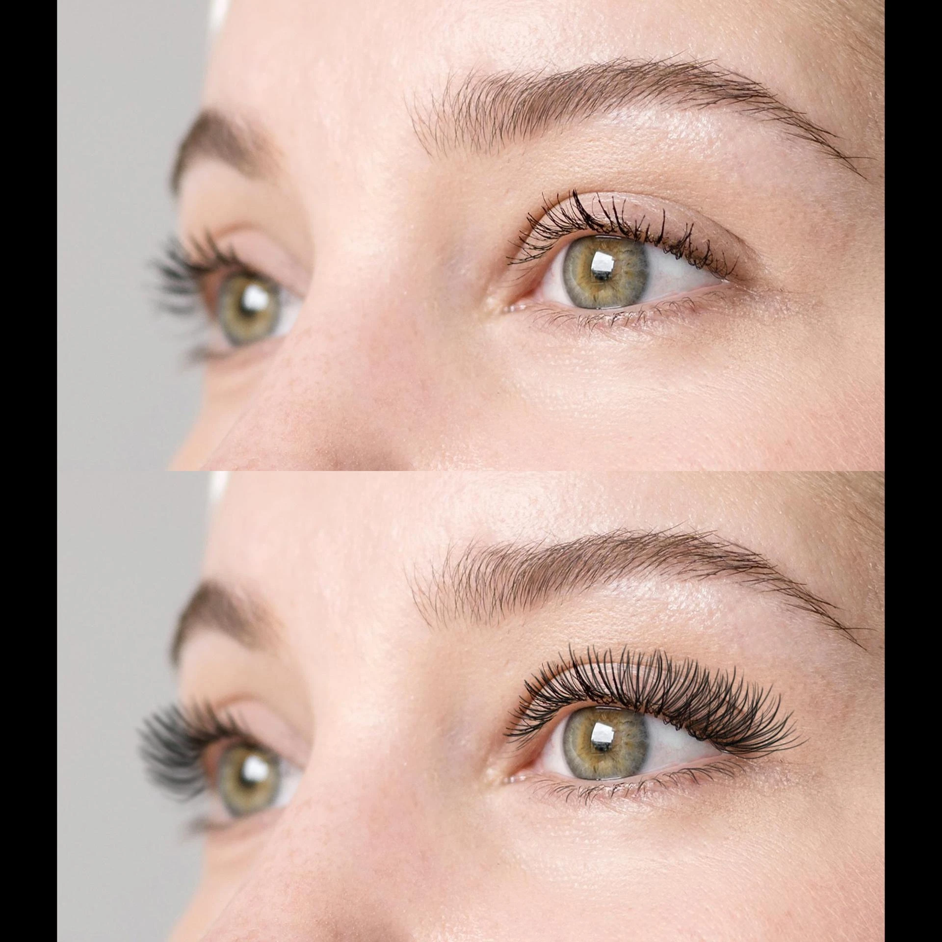 Botox Brow Lift Before and After