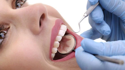 The Role of Deep Cleaning in Periodontal Care ?