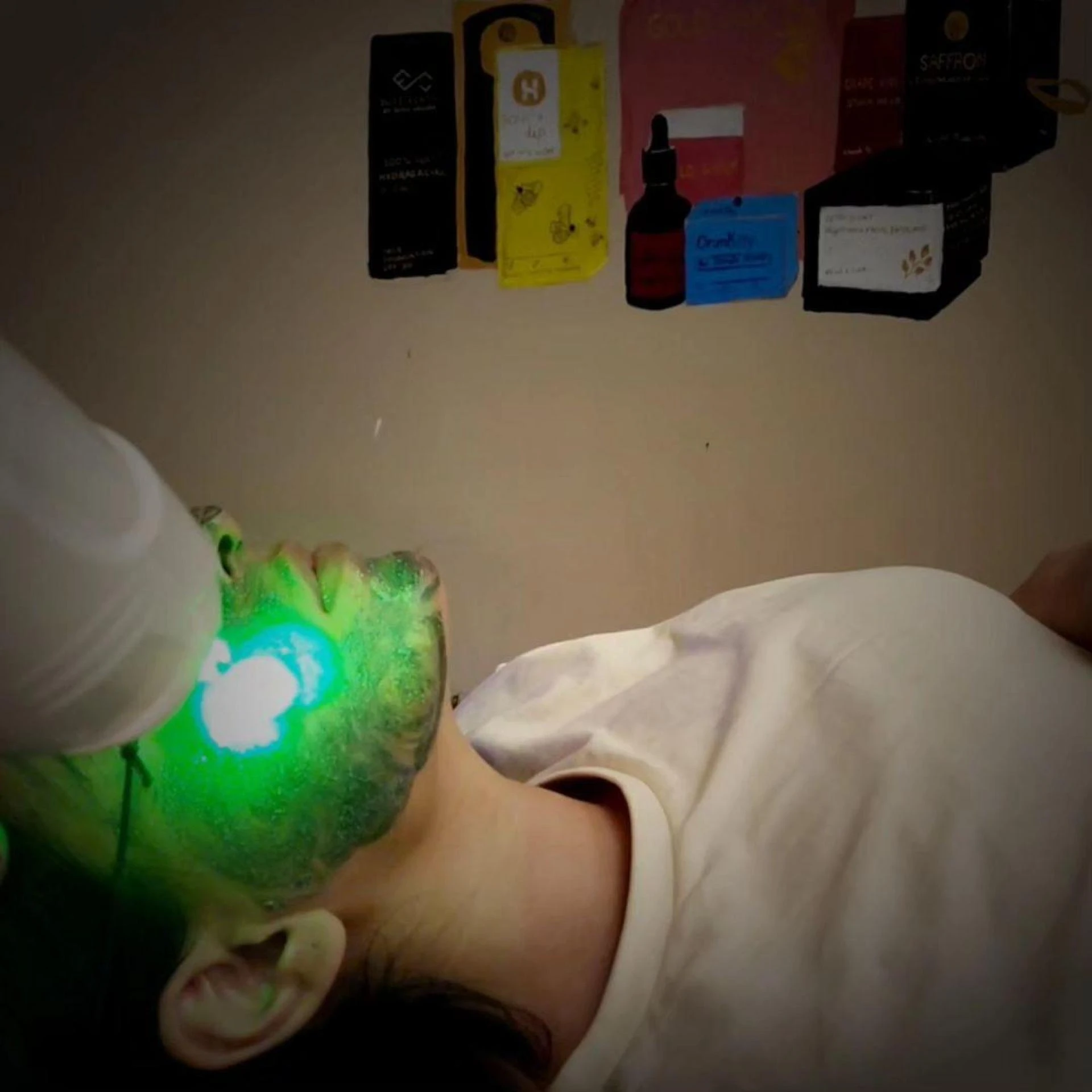 Top 5 Hyperpigmentation Treatments That Work in Pakistan