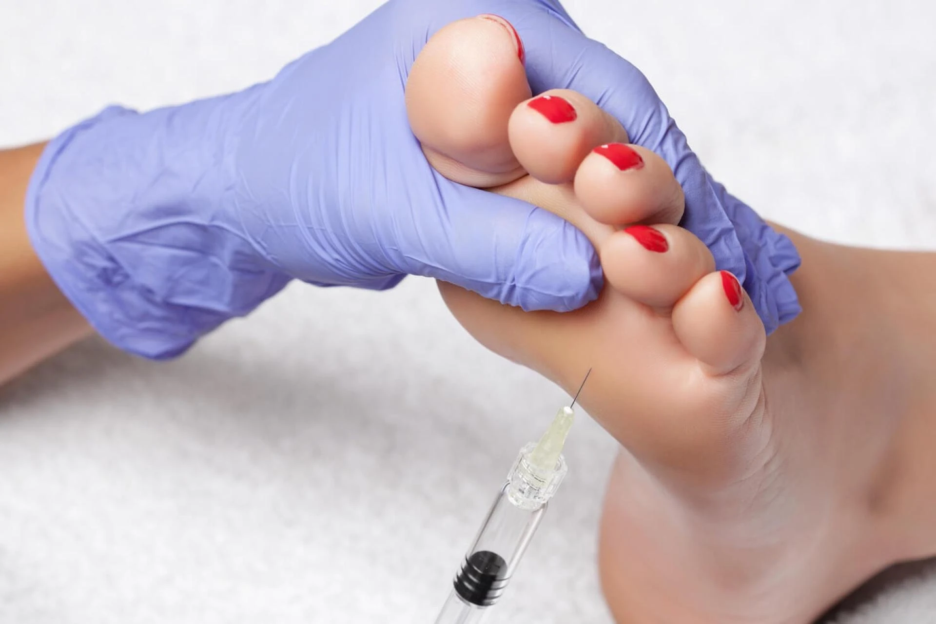 Hyperhidrosis Treatment in Delhi: Safe and Effective Iontophoresis for Sweaty Hands and Feet