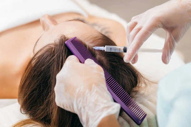 Hair Loss Treatment Delhi: Medical Insights on Modern Therapies