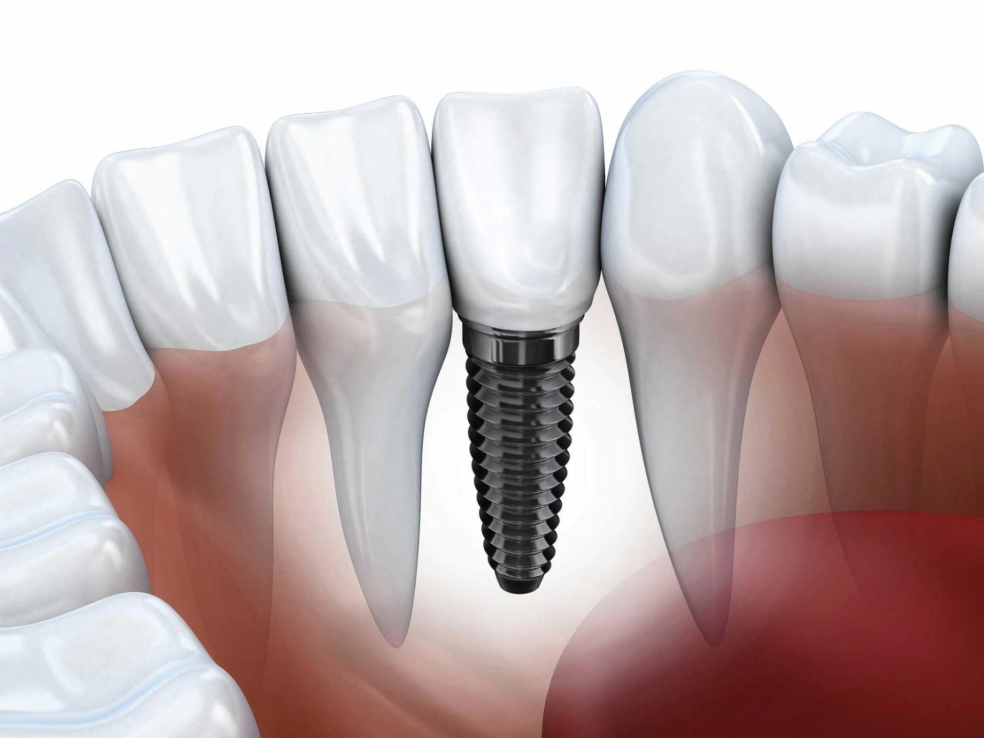 How to Choose the Right Emergency Dentist in San Diego for Urgent Care