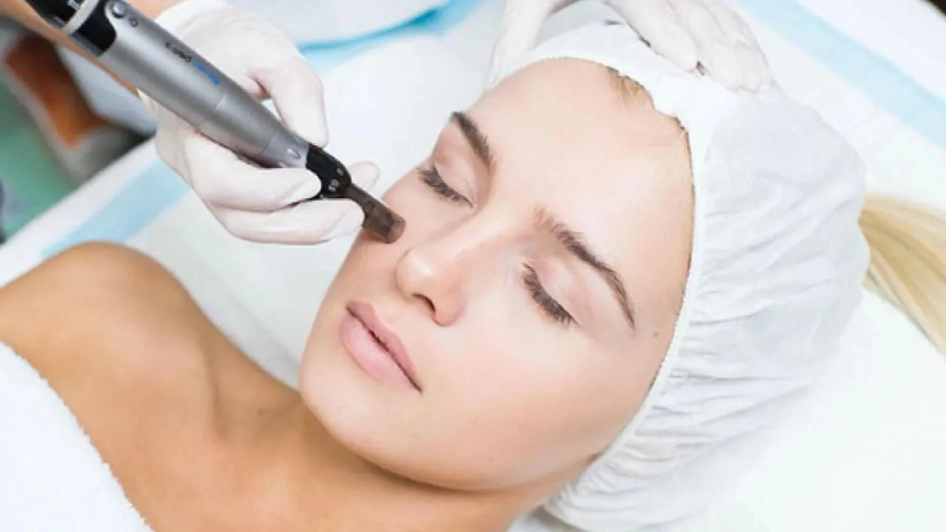 Microneedling Aftercare and Healing: Expert Advice for Radiant Skin