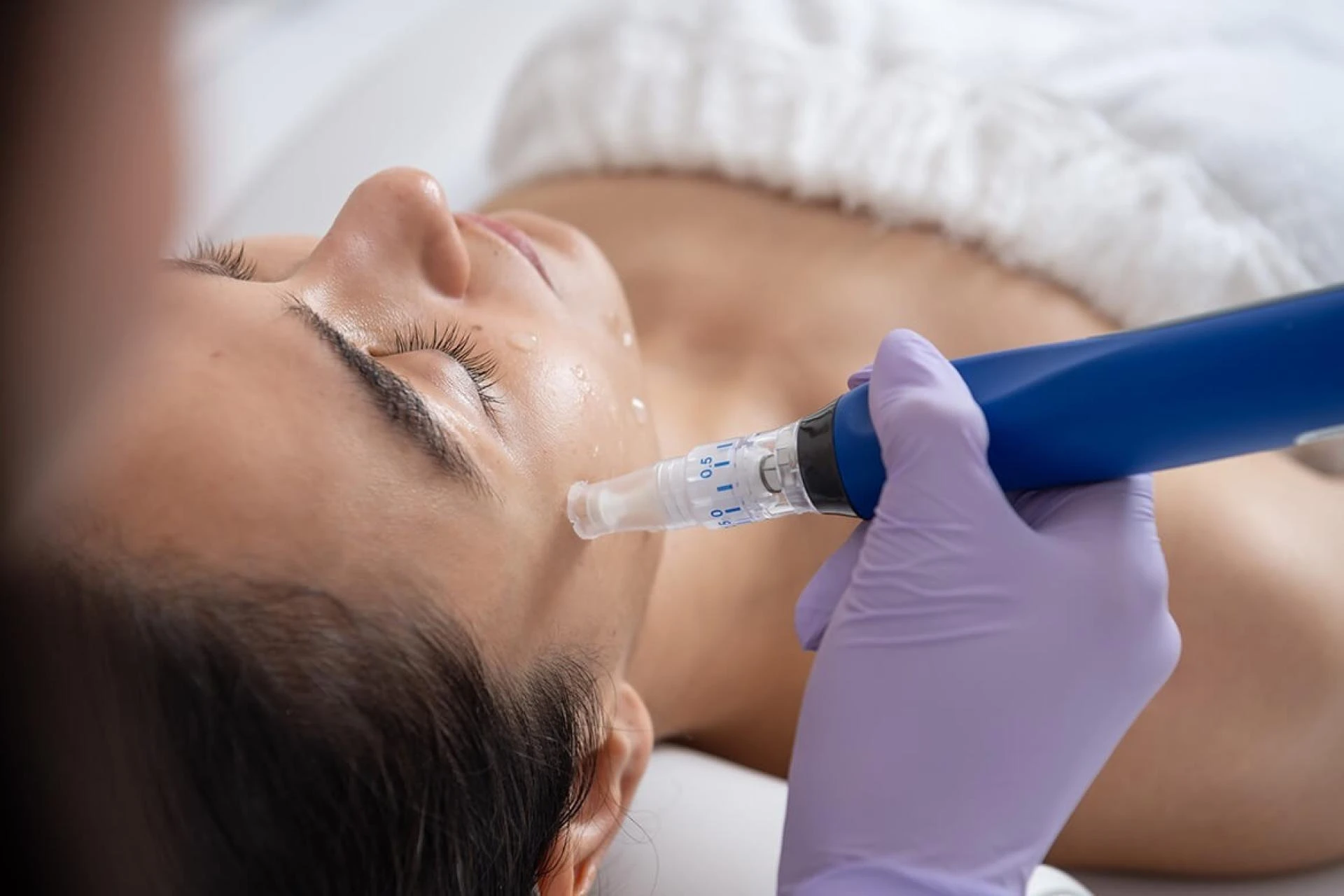 Microneedling Aftercare and Healing: Expert Advice for Radiant Skin
