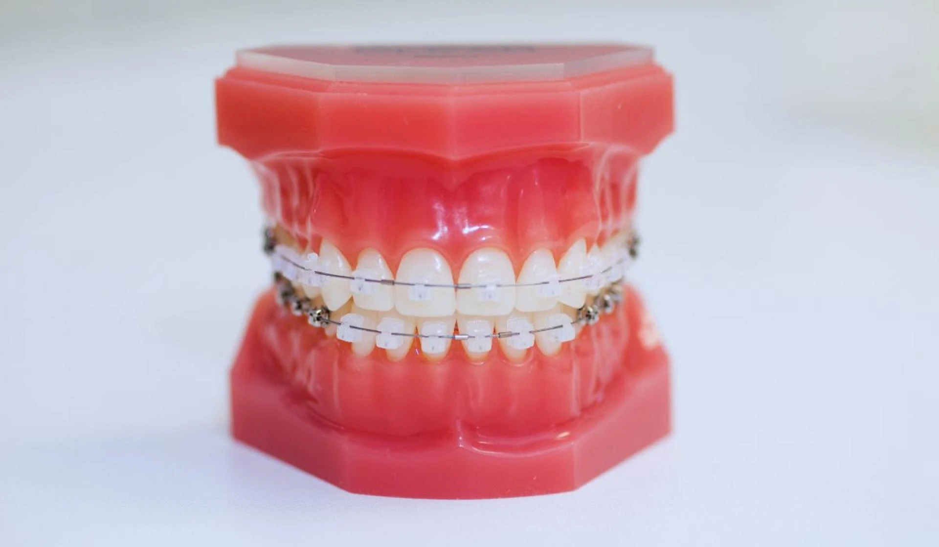 Dental Implant in Lahore – A Permanent Solution for Missing Teeth