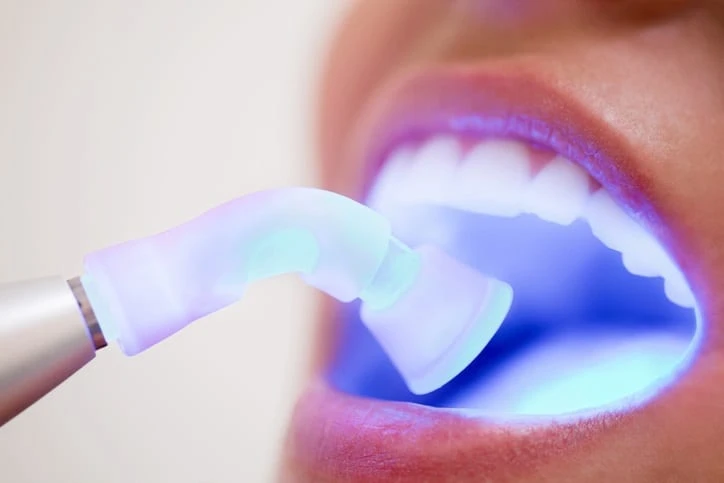 What is Advanced Laser Pocket Disinfection ?