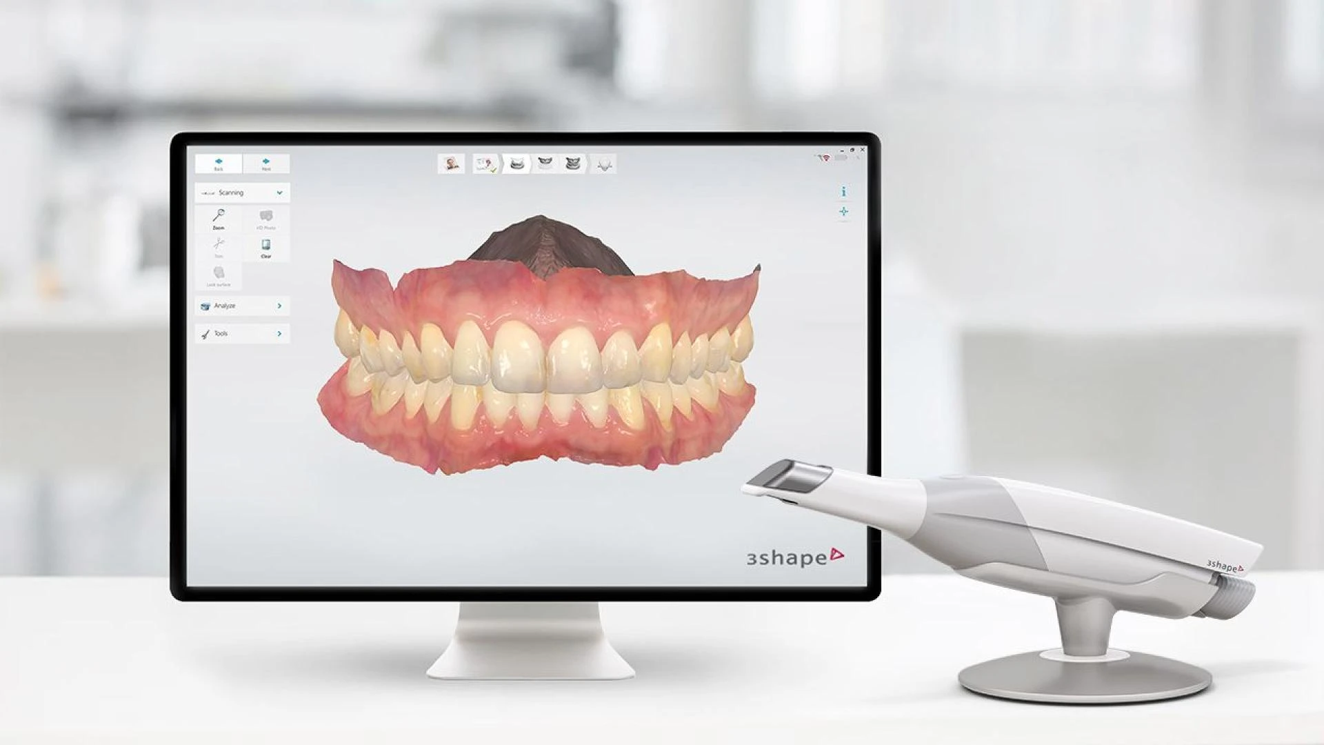 Why Every Dental Clinic Invest in a Trios IntraOral Scanner ?
