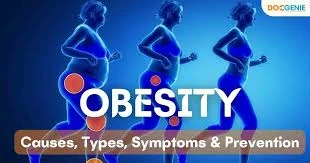 Finding the Best Doctor for Weight Loss Management Online