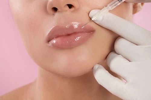 Enhancing Natural Beauty with Lip Fillers in FL