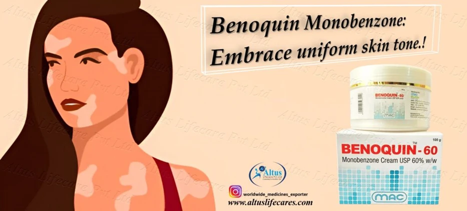 Benoquin 60 Cream – Smooth, Repigmented Skin in Weeks