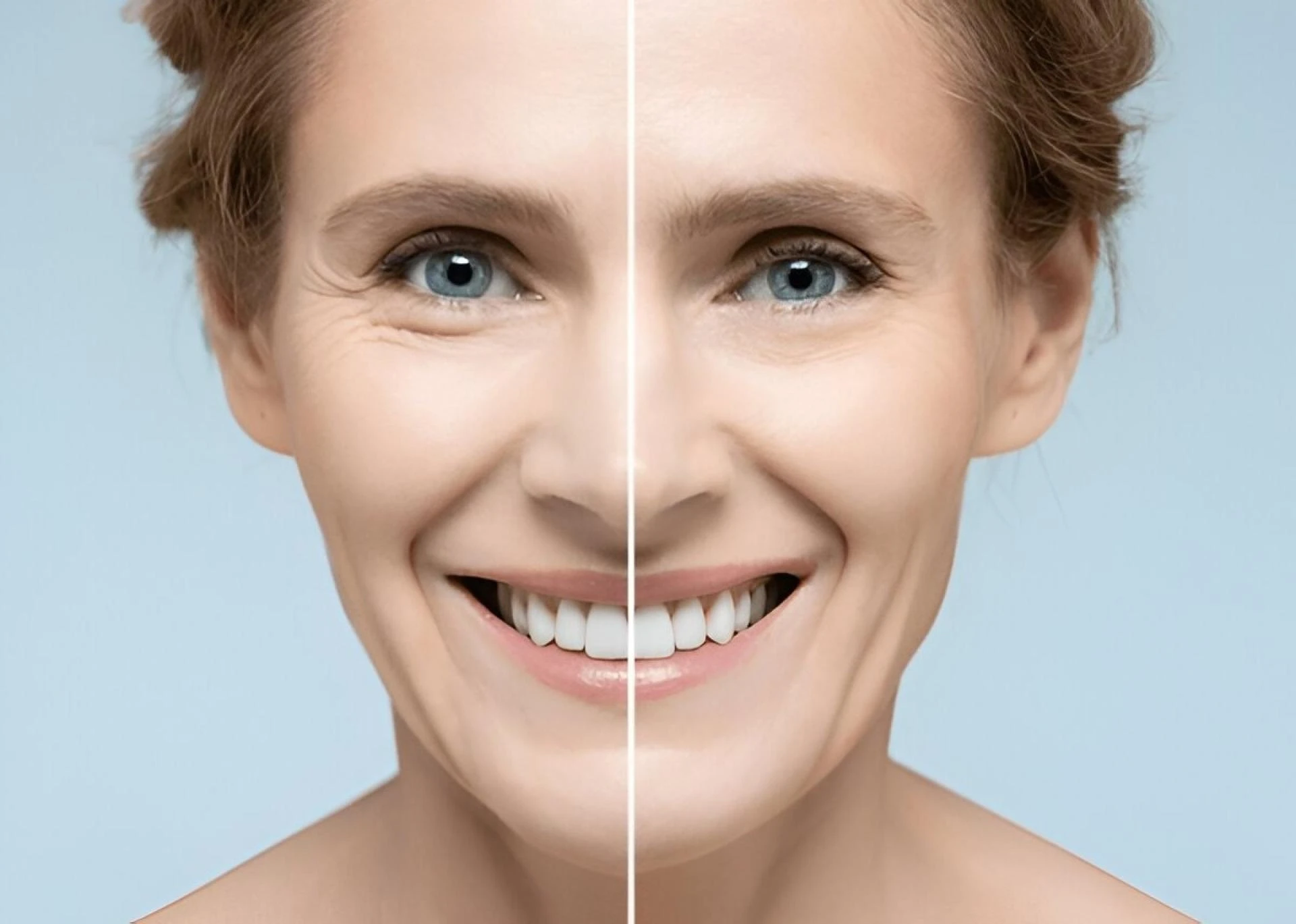 Why Do Wrinkles Form? Causes, Prevention & Treatments